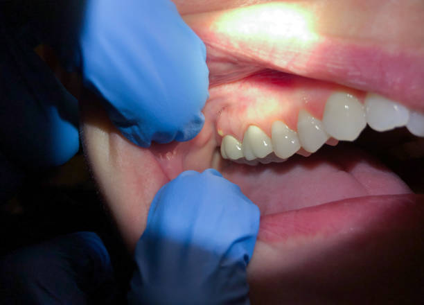 Best Broken Tooth Emergency  in Harvey, MI